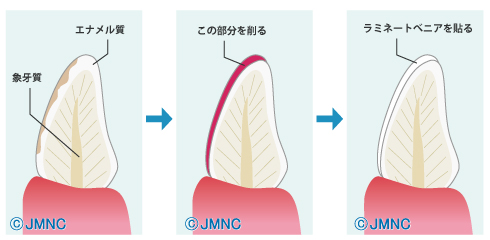 画像"